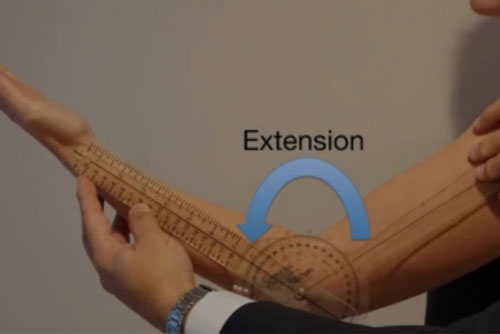 Elbow Contracture Release